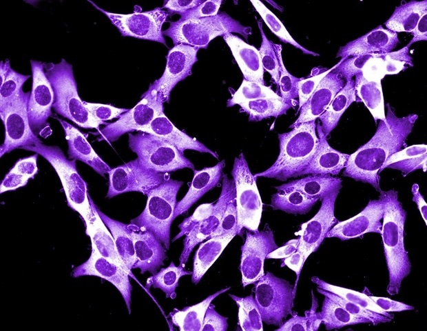 CRATERs identified as key sites for T cell-mediated tumor destruction