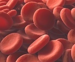 Simple chip-based method for better diagnosis of parasitic infections