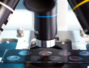 Researchers identify a previously unknown cellular mechanism crucial to coronavirus replication