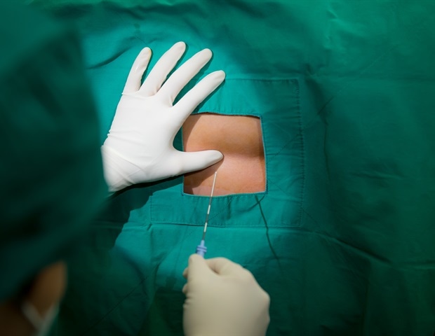 Epidural stimulation and physical rehabilitation can enhance recovery in spinal cord injury patients