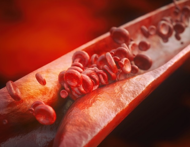 IRF7 reshapes the behavior of vascular smooth muscle cells during atherosclerosis