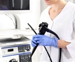 Study finds new treatment technique for displaced gastric mucosa in the esophagus