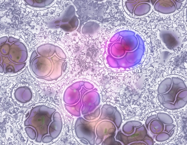 Scientists develop a superior diagnostic tool to spot hidden gene fusions in pediatric cancer