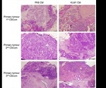 Researchers develop novel in vivo model for studying pancreatic cancer