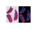 Proscia collaborates with Samsung Medical Center to develop tools for metastasis prediction in lung cancer