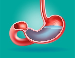 Wnt signaling in fibroblasts drives gastric cancer metastasis to the liver