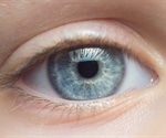 Federal funding boosts effort to make eye transplants a reality