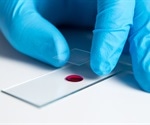 Researchers find STAT3 as therapeutic target for chronic active EBV infection