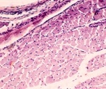 Limitations of Optical Microscopy