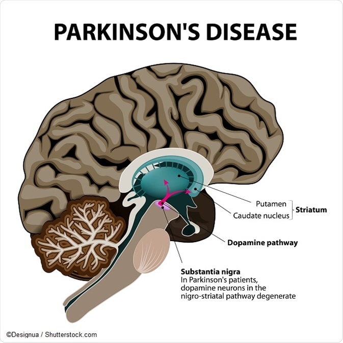 Parkinsons Disease Dopamine 673x673