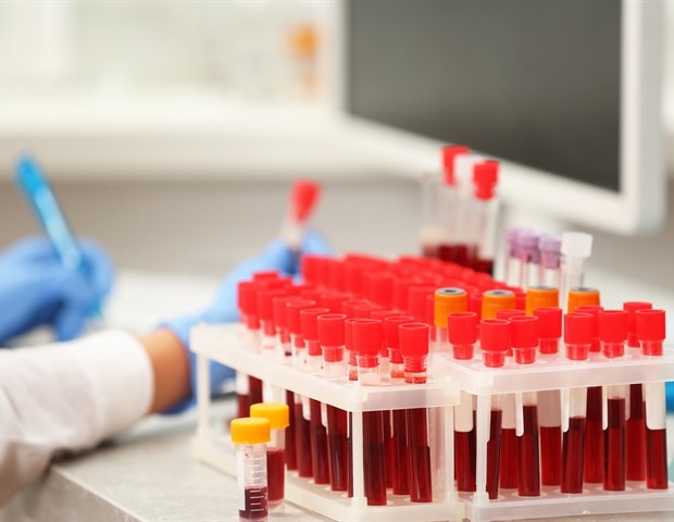 New report outlines practical strategies to improve hematological care for women