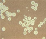 Despite availability of life-saving medicaiton, annual deaths due to fungal meningitis are still over 180,000
