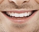 UB researchers build 3D-printed, drug-filled dentures to fight against infections