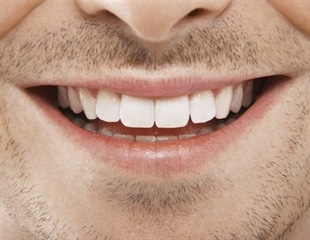 Expert consensus advances evidence-based orthodontic care for adult patients
