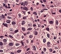 Researchers link genome folding to gene activity and brain tissue organization in Alzheimer's