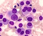 Discovery offers a precise route to treat inflammation associated with neuropathic pain