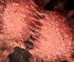 Tall and obese men at increased risk of aggressive prostate cancer, study finds
