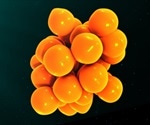 Inflammatory biomarkers may help diagnose chronic fatigue syndrome
