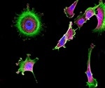 Sample Preparation for Fluorescence Microscopy