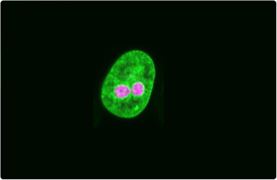 Image courtesy of Christina Caragine and Alexandra Zidovska, Department of Physics, New York University