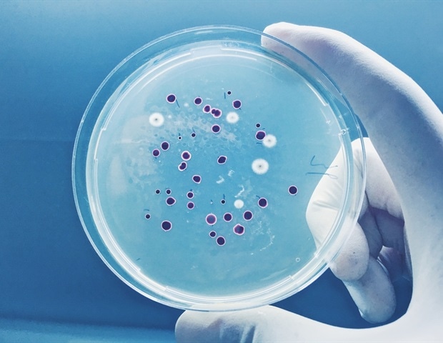 Scientists uncover hidden superfamily of lipid trapping proteins in bacteria