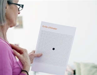 New grant supports research into blinding retinal diseases