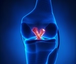 MedShape to demonstrate ExoShape interference fixation device for ACL reconstruction