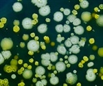 Alcoholic drinks affect oral bacteria tied to diseases