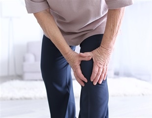 Natural peptide PEPITEM shows promise in reducing arthritic joint swelling