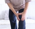 Fibromyalgia prevalence is 2.1% of the general population in Germany