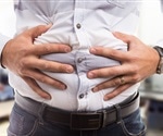 Symptoms of Irritable Bowel Syndrome