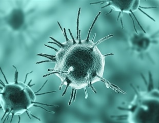 Entamoeba gingivalis linked to severe and recurrent periodontitis
