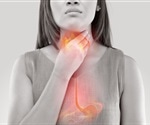 Invasive surgery should be done for select patients with acid reflux, says study