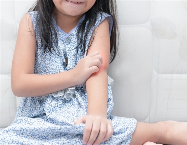 Research shows reluctance among obstetricians to refer pregnant patients to allergy specialists