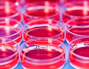 Two scientists win Horwitz Prize for Rett syndrome breakthrough