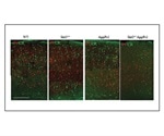 Ketone-supplemented diet may help fight against Alzheimer’s disease