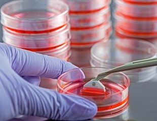 Simplified Mammalian Cell Harvesting without Centrifuging