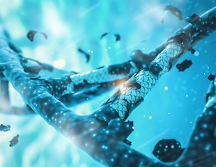 Three decades of progress since the discovery of senescence-associated beta-galactosidase