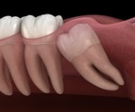 Women making strides in oral and maxillofacial surgery