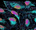Researchers develop light-controlled drug delivery system using liposomes