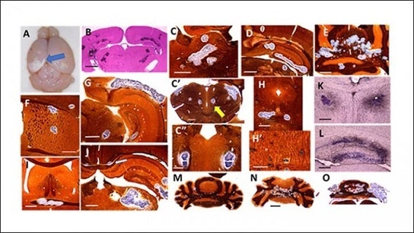 Study reveals long-term behavioral deficits after developmental Zika infection