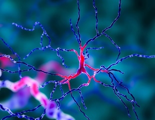 New minimally invasive surgery for epilepsy offers quicker recuperation time for patients