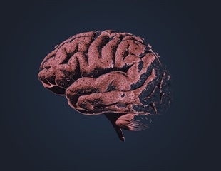 Researchers uncover new clues about the origin of Alzheimer's tau tangles