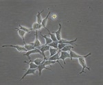 Researchers create p16-Cre ERT2 -tdTomato mouse model to characterize in vivo senescent cells