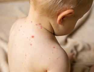 Annenberg poll reveals confusion over RFK Jr. vaccine recommendations