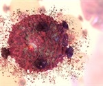 Study reveals that K-Ras gene mutations behave in ways that subvert normal mechanisms of cell death