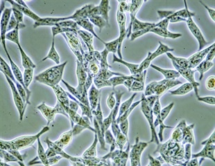New artificial lung mimics breathing and alveolar movement