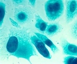 Leaking components from broken muscle fibers activate 'satellite' muscle stem cells