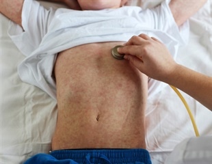 San Antonio scientists use machine learning to identify potential treatments for deadly viruses