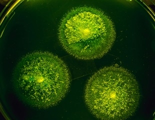 DTU researchers discover gut bacteria link to reduced allergy and asthma risk